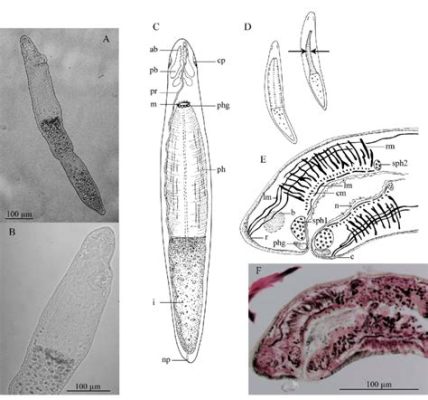  Stenostomum! Das kleine Vielfrass mit dem unwiderstehlichen Charme eines winzigen Vorfahren