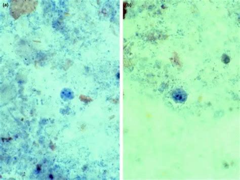 Dientamoeba! Eine mikroskopische Meisterin der Verdauung oder Wie ein einzelliger Parasit das menschliche Leben beeinflusst.